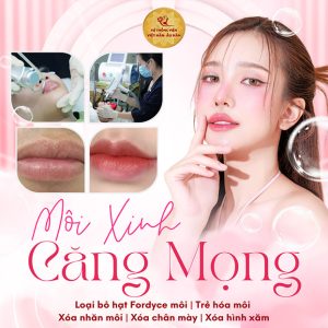 Viện Việt Hàn - Loại Bỏ Hạt Fordyce/ Trẻ Hóa/ Xóa Nhăn Môi