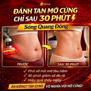 Skin Lab By Hung Nguyen - Giảm Béo Siêu Tốc CN Sóng Quang Đông