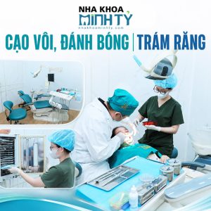Nha Khoa Minh Tỷ - Cạo Vôi, Đánh Bóng/ Trám Răng